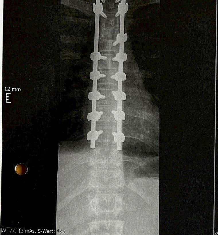 Martina Müller I Resurgence